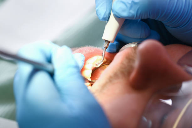 Best Walk-In Emergency Dental Services in Garden City, ID