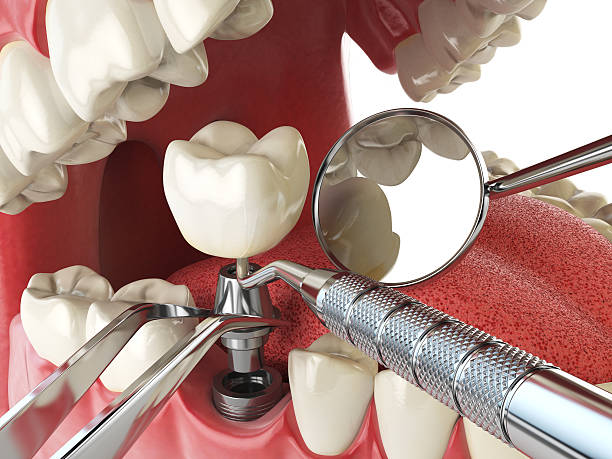 Best Emergency Treatment for Jaw Pain or Injury in Garden City, ID